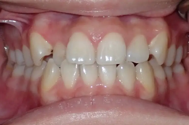 form-ortho-result-49-before