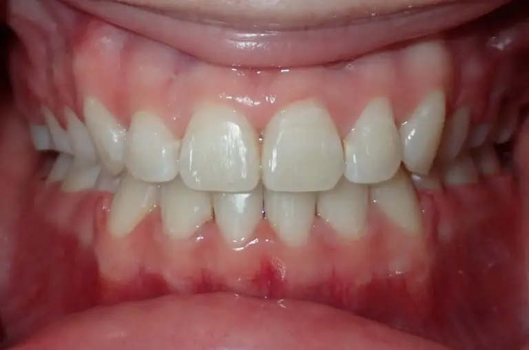 form-ortho-result-50-after