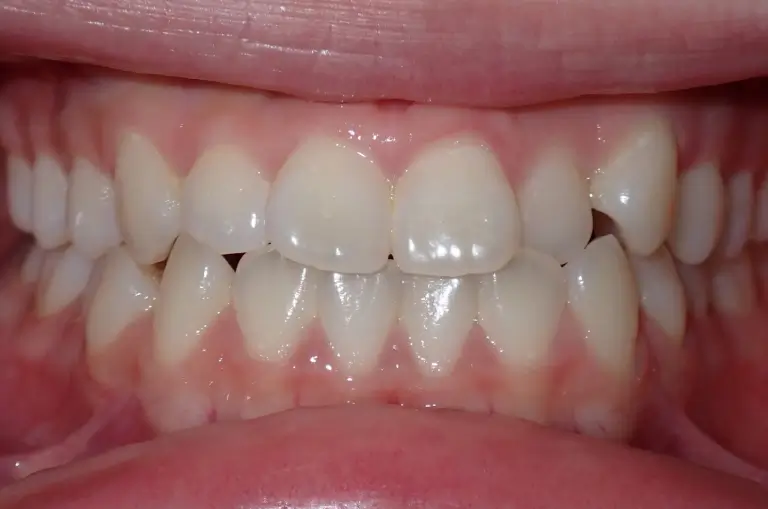 form-ortho-result-50-before